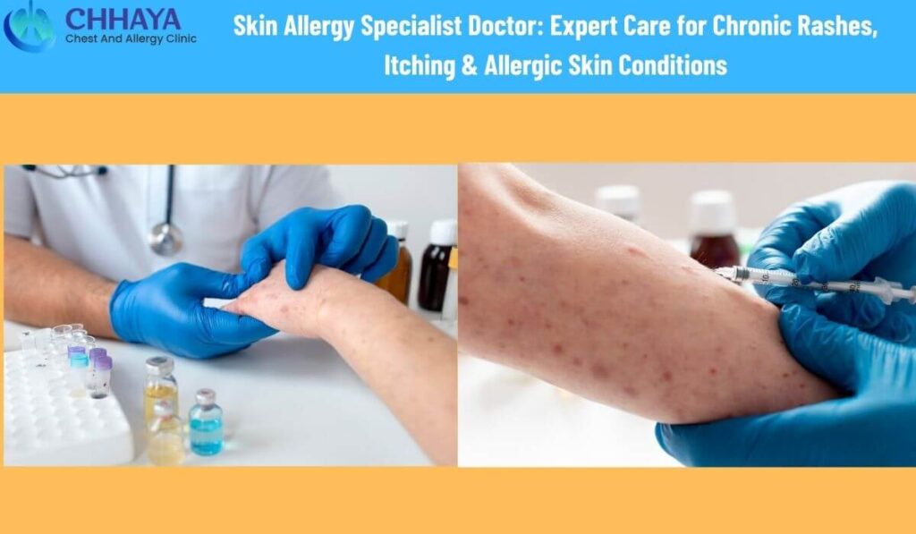  skin allergy specialist doctor in ahmedabad